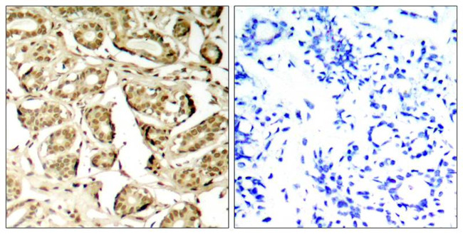 Phospho-MEF2A (Ser408) Antibody in Immunohistochemistry (Paraffin) (IHC (P))