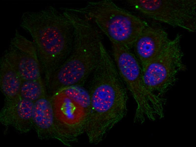 Phospho-MEF2A (Thr319) Antibody in Immunocytochemistry (ICC/IF)