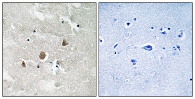 Phospho-MEKK1 (Thr1400) Antibody in Immunohistochemistry (Paraffin) (IHC (P))