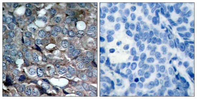 Phospho-ASK1 (Ser83) Antibody in Immunohistochemistry (Paraffin) (IHC (P))