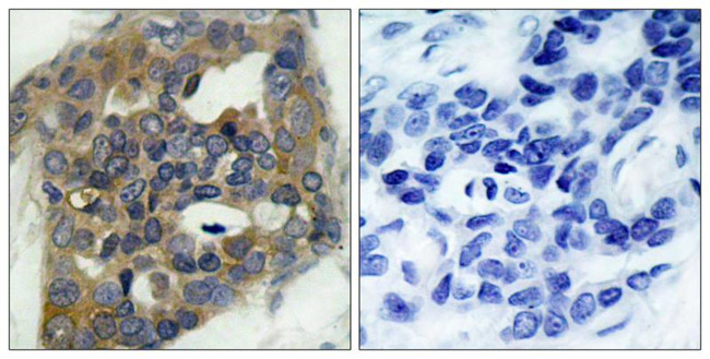 Phospho-ASK1 (Ser966) Antibody in Immunohistochemistry (Paraffin) (IHC (P))