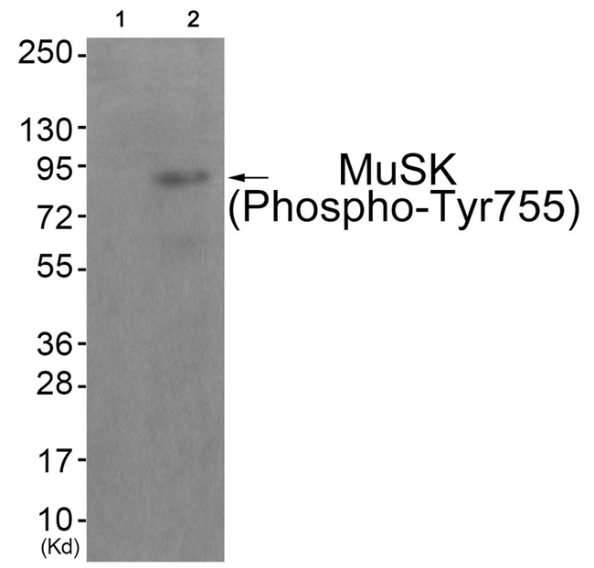 Phospho-MUSK (Tyr755) Antibody in Western Blot (WB)