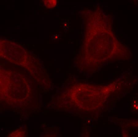 Phospho-NFkB p105 (Ser927) Antibody in Immunocytochemistry (ICC/IF)