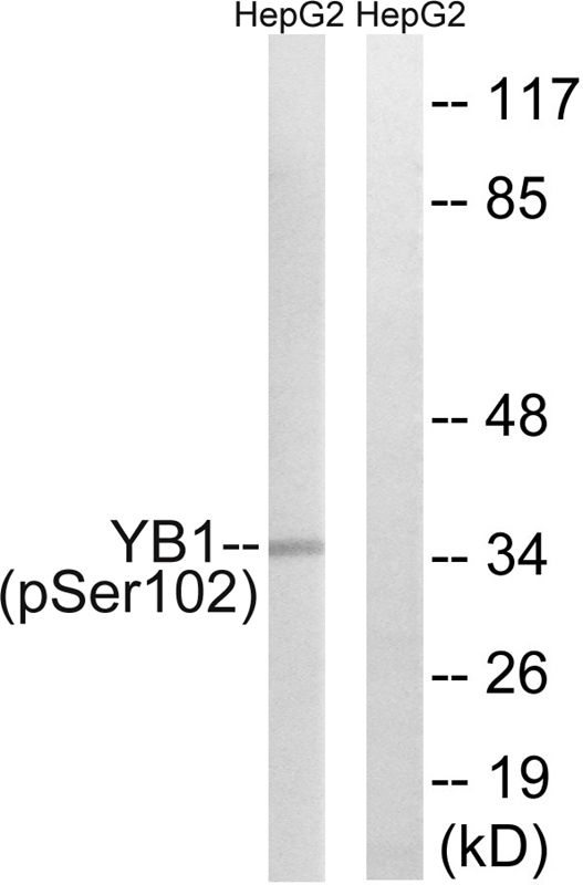 Phospho-YBX1 (Ser102) Antibody in Western Blot (WB)