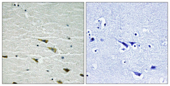 Phospho-TrkA (Tyr757) Antibody in Immunohistochemistry (Paraffin) (IHC (P))