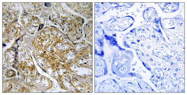 Phospho-PAK1 (Ser199) Antibody in Immunohistochemistry (Paraffin) (IHC (P))