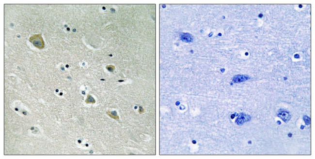 Phospho-PAK1 (Ser204) Antibody in Immunohistochemistry (Paraffin) (IHC (P))