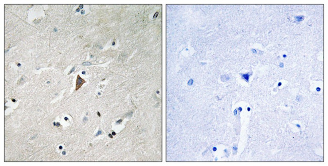 Phospho-PDPK1 (Tyr9) Antibody in Immunohistochemistry (Paraffin) (IHC (P))