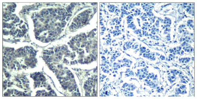 Phospho-PLCG2 (Tyr1217) Antibody in Immunohistochemistry (Paraffin) (IHC (P))
