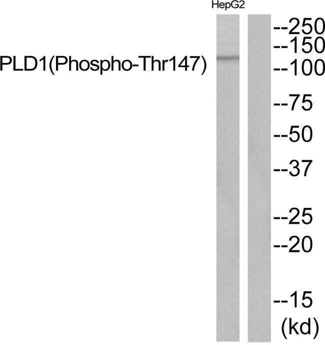 Phospho-PLD1 (Thr147) Antibody in Western Blot (WB)