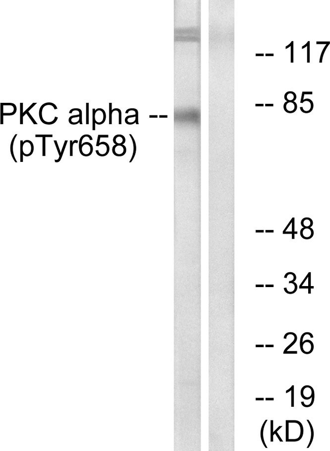 Phospho-PKC alpha (Tyr658) Antibody in Western Blot (WB)