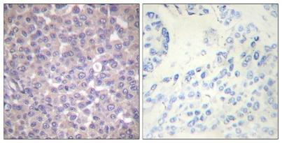 Phospho-SHP-1 (Tyr536) Antibody in Immunohistochemistry (Paraffin) (IHC (P))