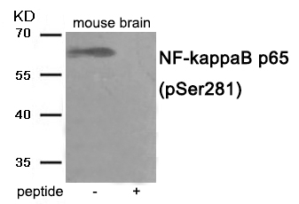 Phospho-NFkB p65 (Ser281) Antibody in Western Blot (WB)