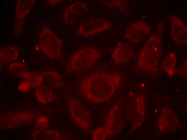 Phospho-NFkB p65 (Ser468) Antibody in Immunocytochemistry (ICC/IF)