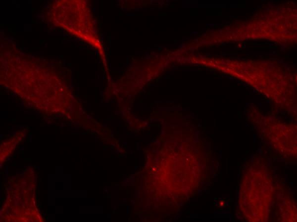 Phospho-NFkB p65 (Ser529) Antibody in Immunocytochemistry (ICC/IF)