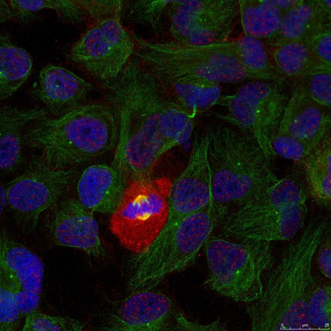 Phospho-NFkB p65 (Thr254) Antibody in Immunocytochemistry (ICC/IF)