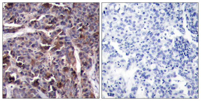 Phospho-NFkB p65 (Thr505) Antibody in Immunohistochemistry (Paraffin) (IHC (P))