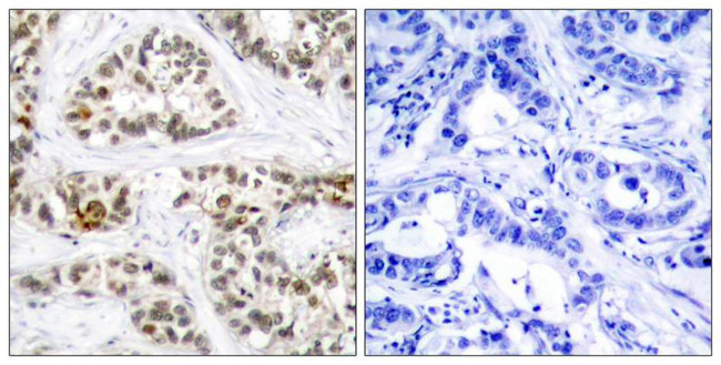 Phospho-RelB (Ser573) Antibody in Immunohistochemistry (Paraffin) (IHC (P))