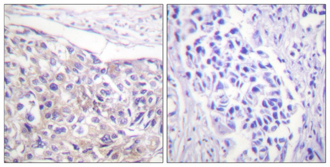 Phospho-RSK1 (Thr573) Antibody in Immunohistochemistry (Paraffin) (IHC (P))