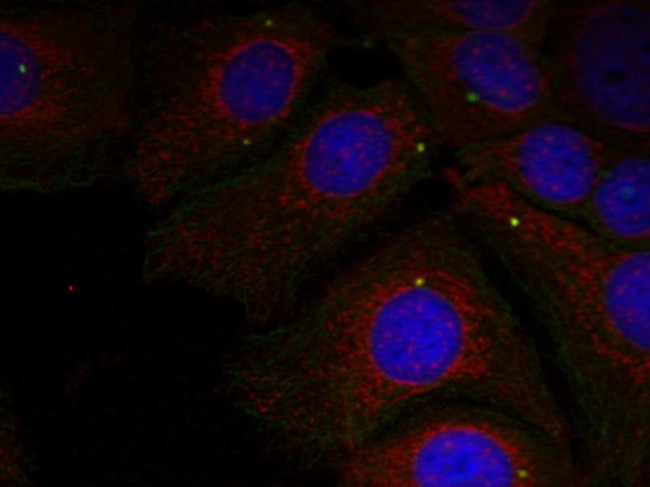 Phospho-alpha Synuclein (Tyr125) Antibody in Immunocytochemistry (ICC/IF)