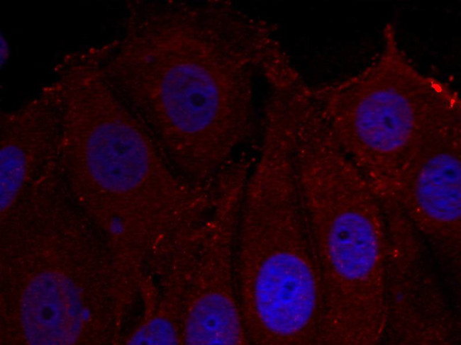 Phospho-alpha Synuclein (Tyr133) Antibody in Immunocytochemistry (ICC/IF)
