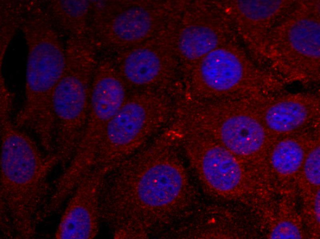 Phospho-alpha Synuclein (Tyr136) Antibody in Immunocytochemistry (ICC/IF)