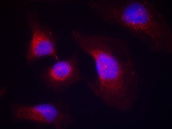 Phospho-Syk (Tyr323) Antibody in Immunocytochemistry (ICC/IF)