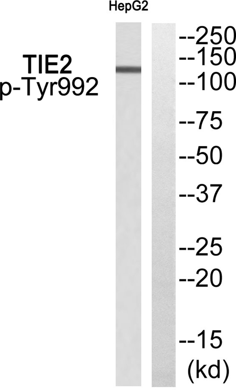 Phospho-TEK (Tyr992) Antibody in Western Blot (WB)