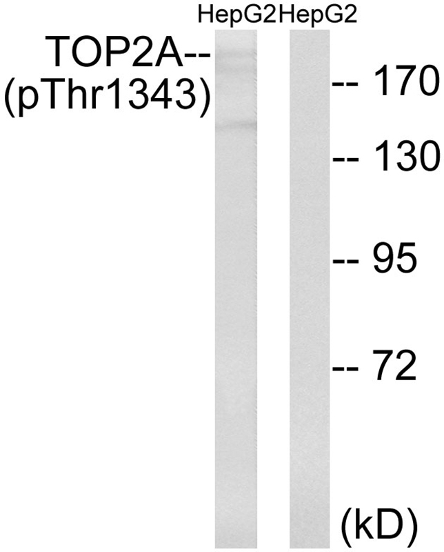 Phospho-TOP2A (Thr1343) Antibody in Western Blot (WB)