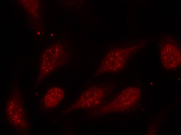 Phospho-p53 (Ser315) Antibody in Immunocytochemistry (ICC/IF)