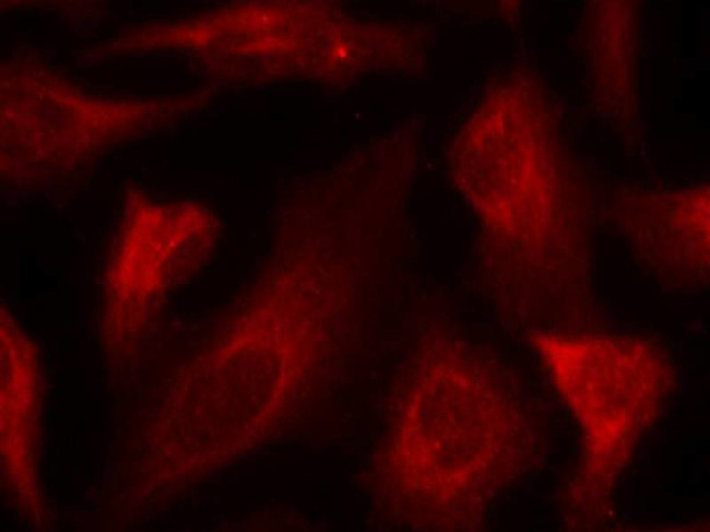 Phospho-p53 (Ser33) Antibody in Immunocytochemistry (ICC/IF)