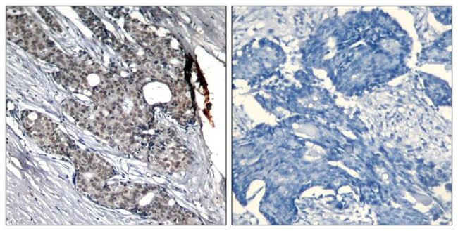 Phospho-p53 (Ser6) Antibody in Immunohistochemistry (Paraffin) (IHC (P))