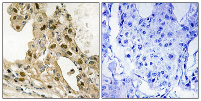 Phospho-p53 (Thr387) Antibody in Immunohistochemistry (Paraffin) (IHC (P))