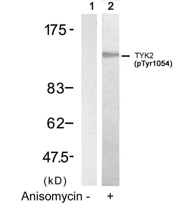 Phospho-TYK2 (Tyr1054) Antibody in Western Blot (WB)
