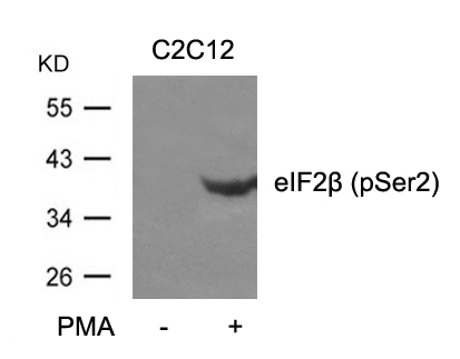 Phospho-eIF2 beta (Ser2) Antibody in Western Blot (WB)