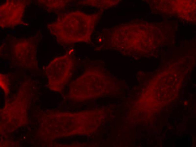 Phospho-DOK2 (Tyr299) Antibody in Immunocytochemistry (ICC/IF)