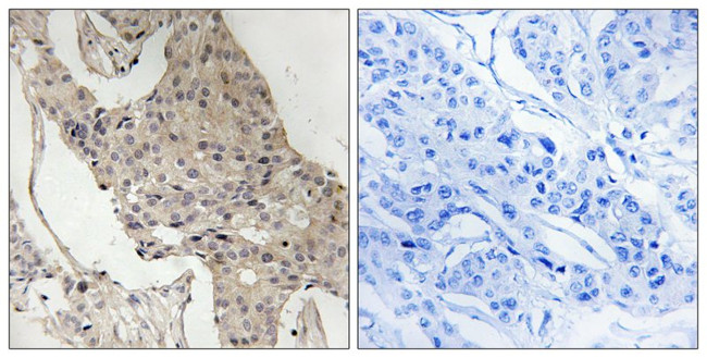 Phospho-GAB2 (Ser623) Antibody in Immunohistochemistry (Paraffin) (IHC (P))