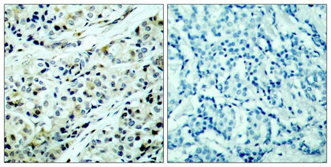 Phospho-HDAC5 (Ser498) Antibody in Immunohistochemistry (Paraffin) (IHC (P))