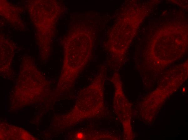 Phospho-PRMT4 (Ser228) Antibody in Immunocytochemistry (ICC/IF)