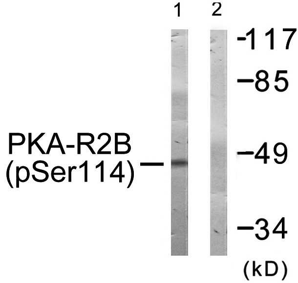 Phospho-PRKAR2B (Ser114) Antibody in Western Blot (WB)