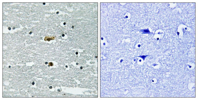 Phospho-STK39 (Ser309) Antibody in Immunohistochemistry (Paraffin) (IHC (P))