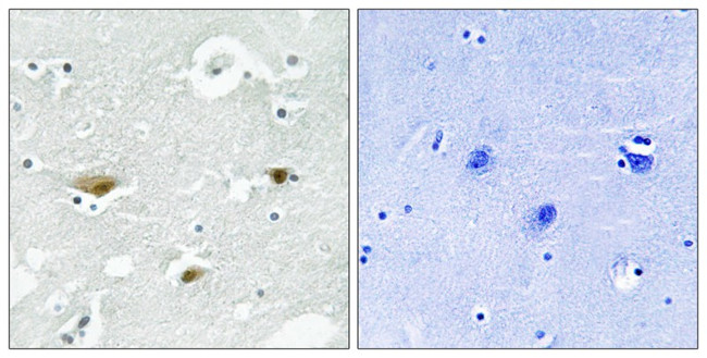 Phospho-STK39 (Ser323) Antibody in Immunohistochemistry (Paraffin) (IHC (P))