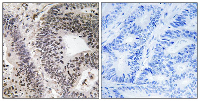 Phospho-WWOX (Tyr33) Antibody in Immunohistochemistry (Paraffin) (IHC (P))