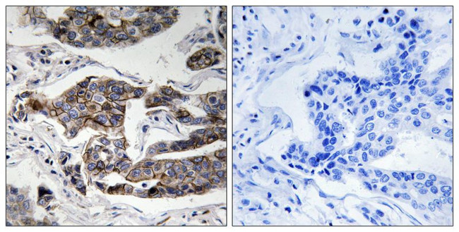 Phospho-Girdin (Ser1417) Antibody in Immunohistochemistry (Paraffin) (IHC (P))