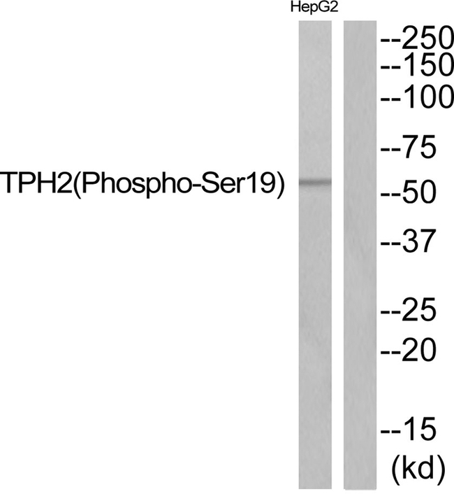 Phospho-TPH2 (Ser19) Antibody in Western Blot (WB)