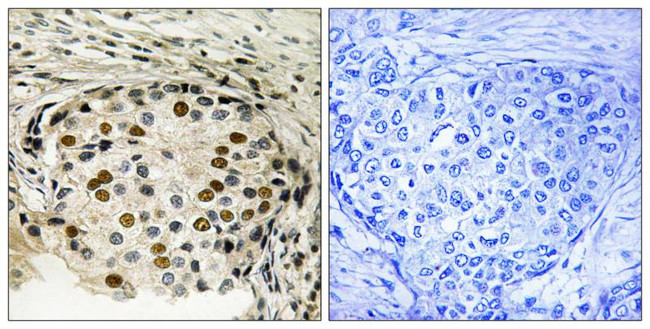 Phospho-OSR1 (Thr185) Antibody in Immunohistochemistry (Paraffin) (IHC (P))