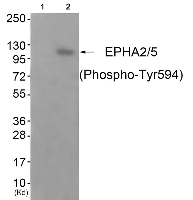 Phospho-EphA2/EphA5 (Tyr594) Antibody in Western Blot (WB)