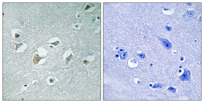Phospho-MLK1/MLK2 (Thr312, Thr266) Antibody in Immunohistochemistry (Paraffin) (IHC (P))