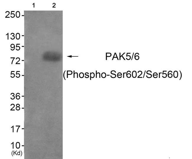 Phospho-PAK5/PAK6 (Ser602, Ser560) Antibody in Western Blot (WB)