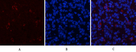 Phospho-ERK1/ERK2 (Thr202, Tyr204) Antibody in Immunocytochemistry (ICC/IF)